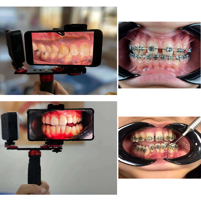 Dentistry Material Mobile Phon – Photography Mobile Lighting recenzja i cena